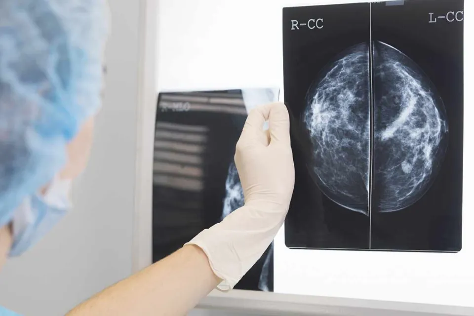 Cáncer de mama diagnóstico 