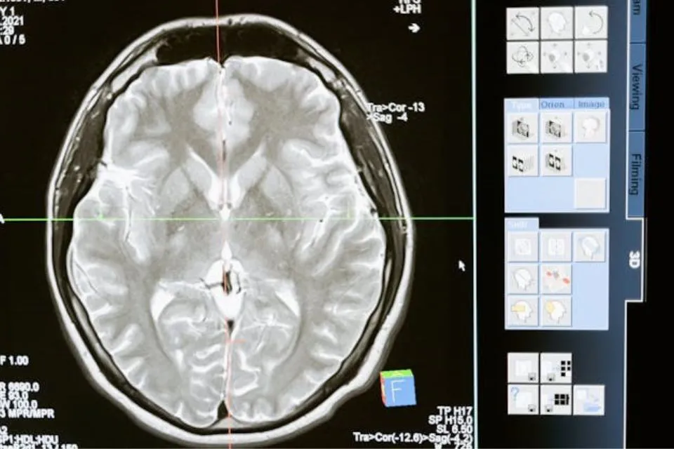 Examen cerebro 