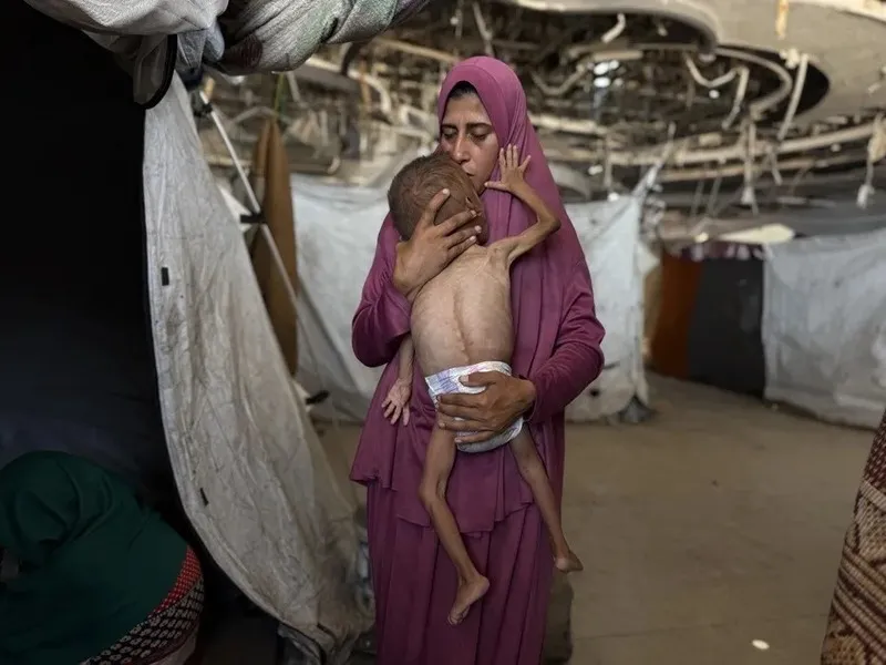 ONU confirma oficialmente la hambruna en la Franja de Gaza|Foto: EFE/Ahmad Awad ONU confirma oficialmente la hambruna en la Franja de Gaza