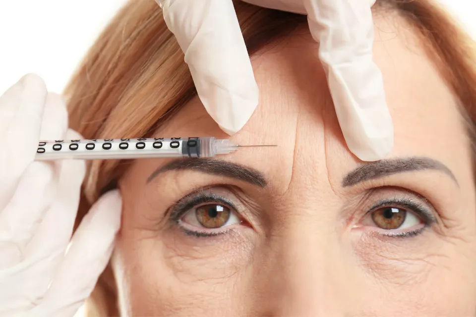 Bótox tratamiento facial 