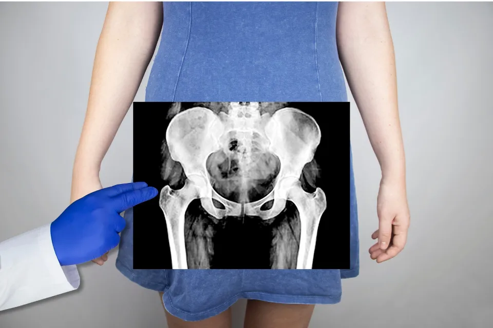 Pelvis - salud y bienestar