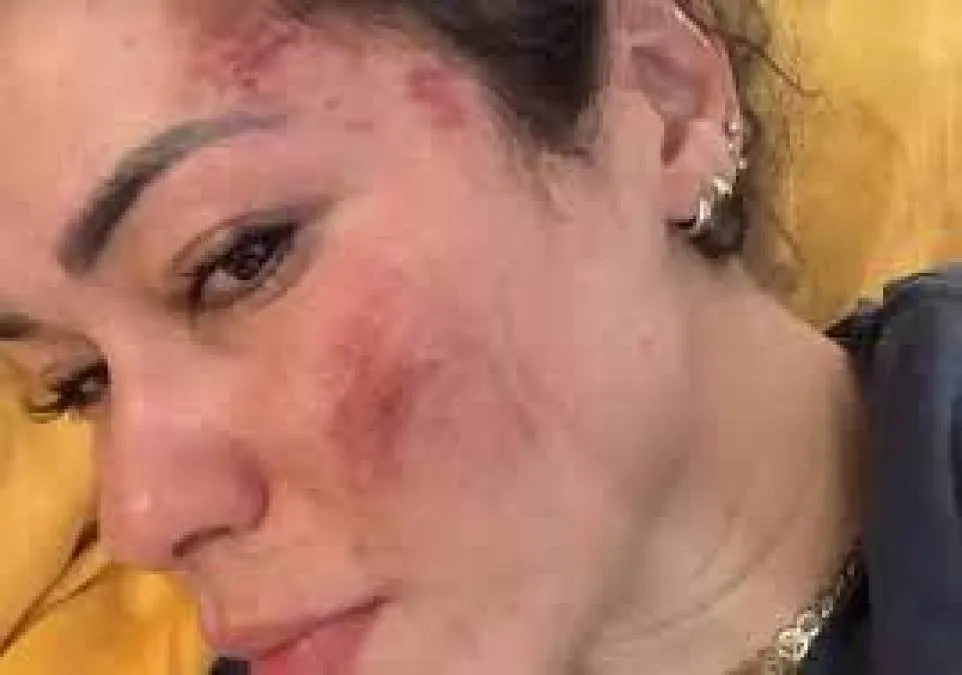 Noticias -Fernanda Violación