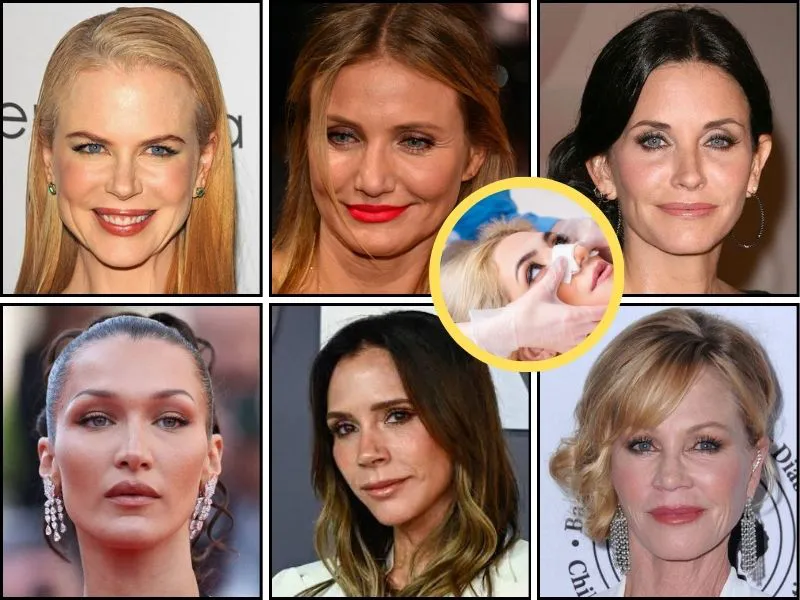 celebridades-arrepentidas-cirugia-plastica Nicole Kidman, Cameron Diaz y otras estrellas han confesado su arrepentimiento por la cirugía plástica. Un fenómeno cultural que refleja la presión estética en la industria.  
