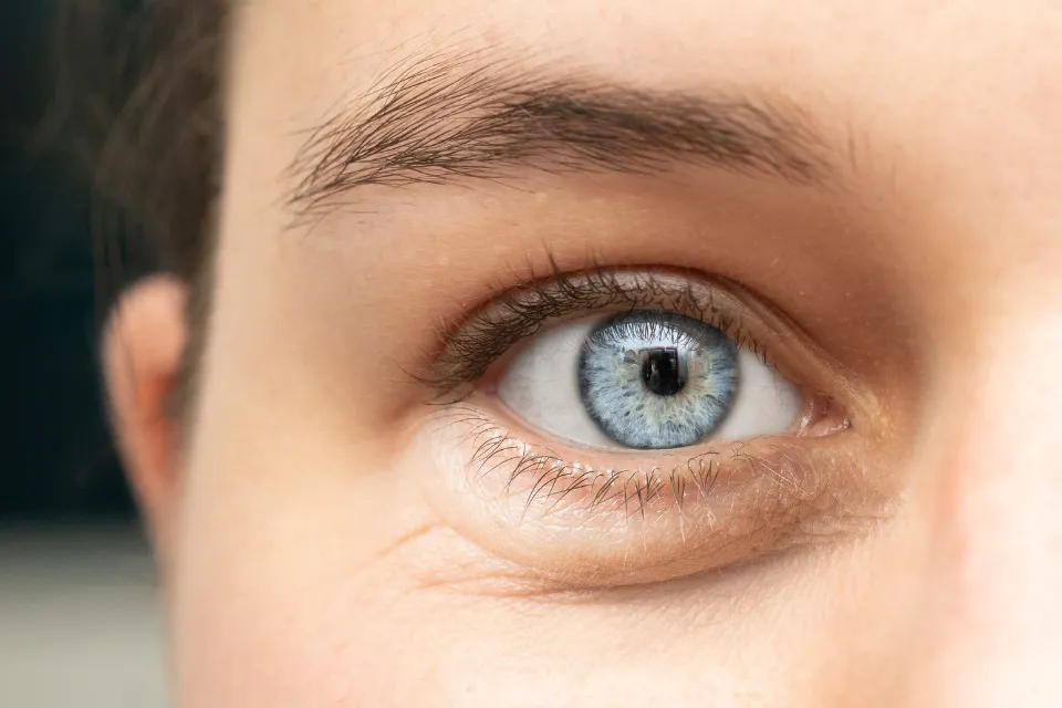 Bolsas de ojos 